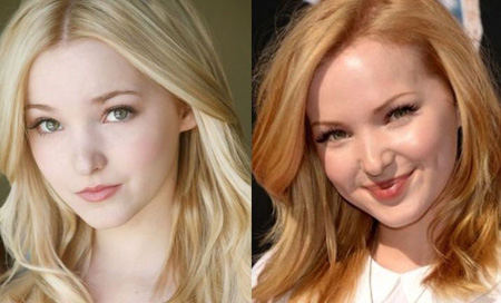Dove Cameron's dimples are more profound now than before.
